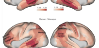 Here’s a visual tour of what makes the human brain distinct from our ape relatives